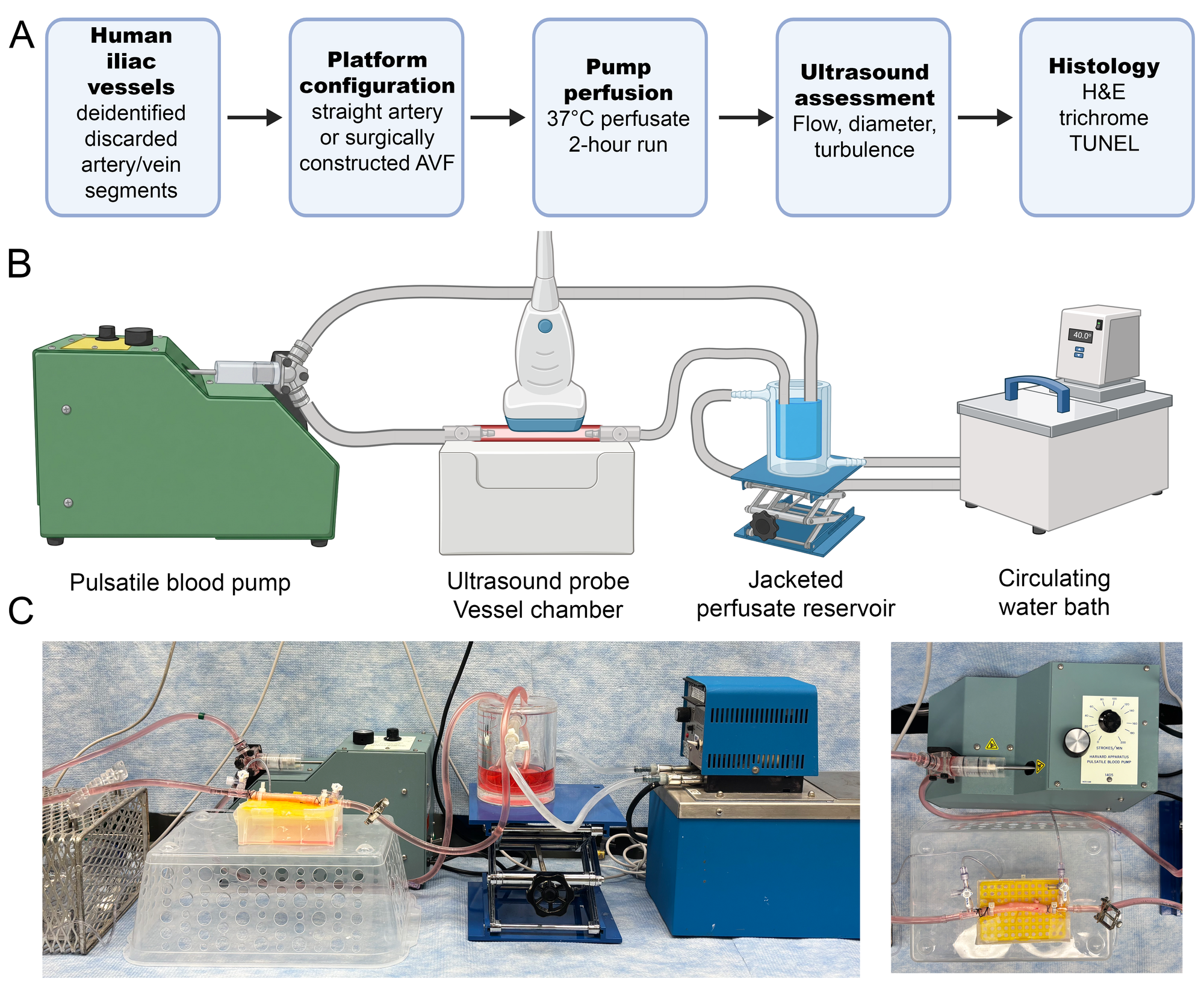 Human vessel perfusion workflow, circuit schematic, and experimental platform photographs